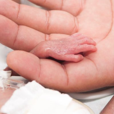 151162-premature-baby